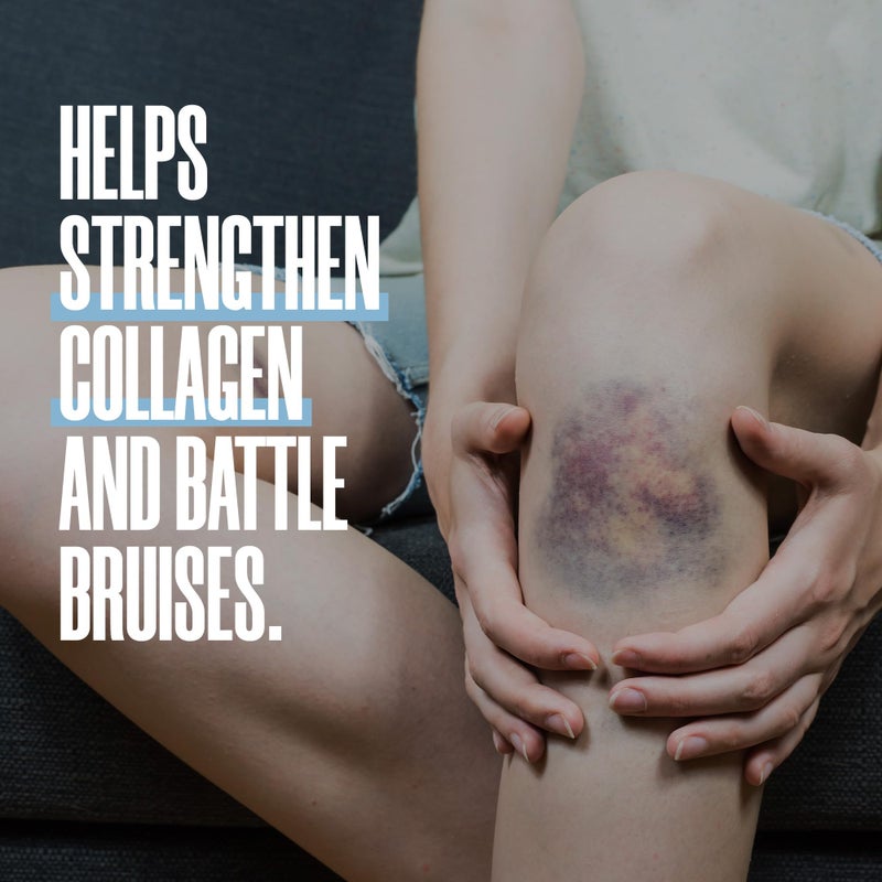 ZAX'S ORIGINAL ZAX'S Bruise Vitamin Pharmacist Developed Bruising Supplements Potent Bruising Swelling Reducer, Zinc, Vitamin K, D3, Ascorbic Acid, Citrus Bioflavonoids, 60 Caps, Combine Arnica Bruise Cream - Image 3