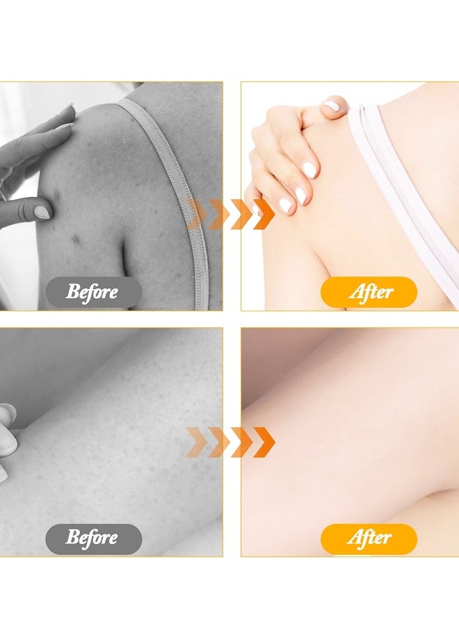 2Pcs Upgrade 2-in-1 Sunflower Bath Ball,Soft Bath Ball with Hanging and Adsorbable Suction Cup，Exfoliating Bath Sponges - Image 5