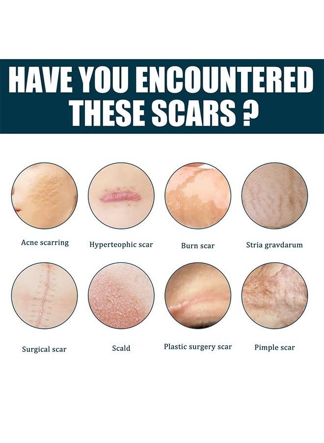 إيلهو جل الندبات المتقدم، جل طبي لإزالة الندبات، جل متقدم لإزالة الندبات الجراحية، علامات التمدد، حب الشباب، الإصابات، الحروق، الجدرة، الندبات القديمة والجديدة المتضخمة، 50 مل - Image 4