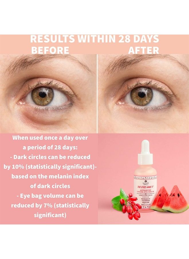 Nature Spell Advanced Under Eye Serum with Watermelon & Goji Berries 1 Fl Oz– Targets Dark Circles, Puffiness & Eyebags – Anti Wrinkle Under Eye Cream - 100% Vegan – Made in the UK - Image 1