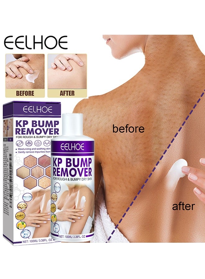 EELHOE KP Bump Remover - 100ml Pilaris Keratinizing Moisturizer with Lactic Acid - Exfoliating and Moisturizing Cream for Problematic Keratinization, Dry, Rough and Bumpy Skin - Image 1