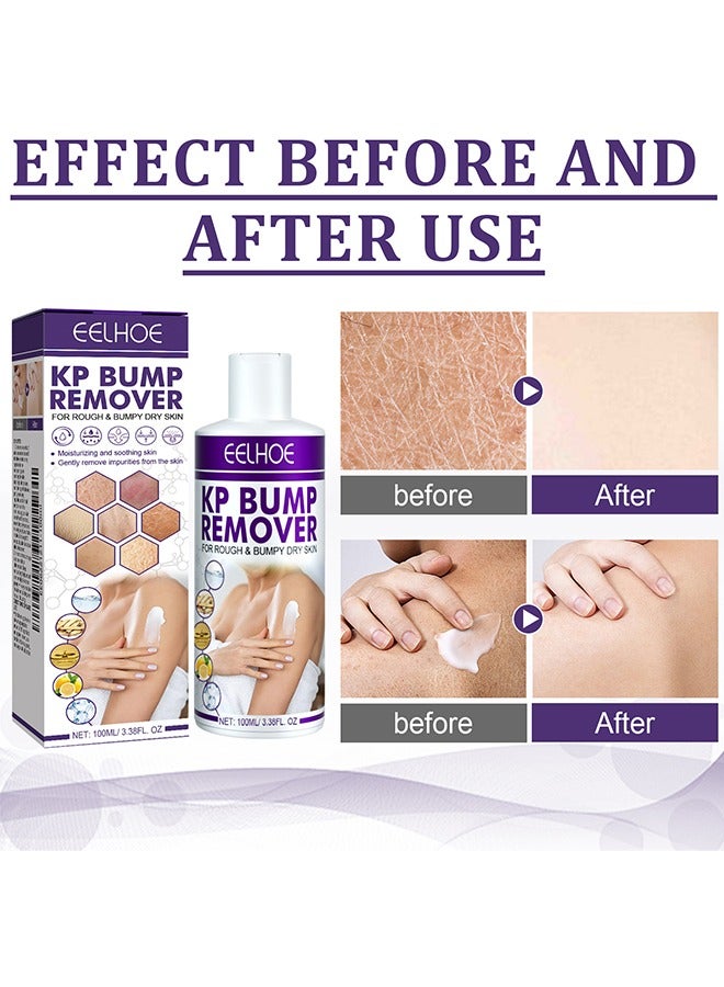 EELHOE KP Bump Remover - 100ml Pilaris Keratinizing Moisturizer with Lactic Acid - Exfoliating and Moisturizing Cream for Problematic Keratinization, Dry, Rough and Bumpy Skin - Image 3