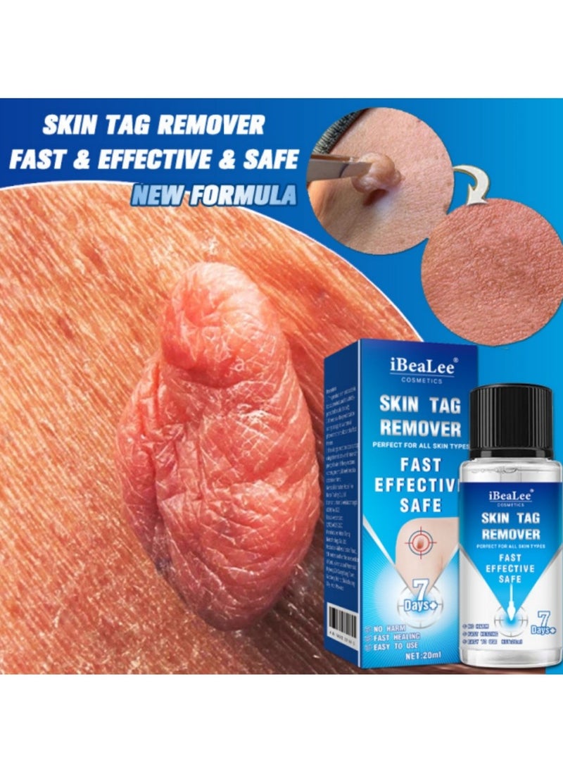 iBealee Wart Removal Essential Oil A Gentle Safe With Natural Extracts For All Skin Types Universal For Both Men And Women  - Image 1