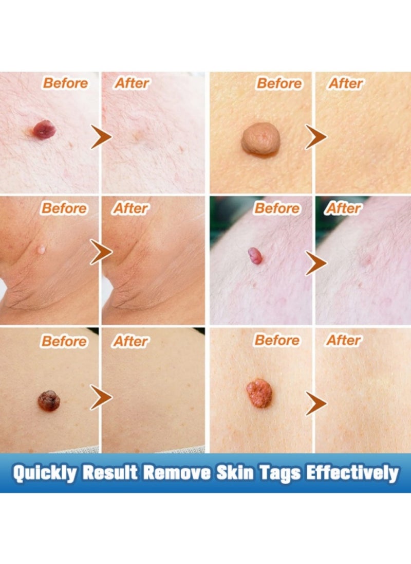 iBealee Wart Removal Essential Oil A Gentle Safe With Natural Extracts For All Skin Types Universal For Both Men And Women  - Image 5