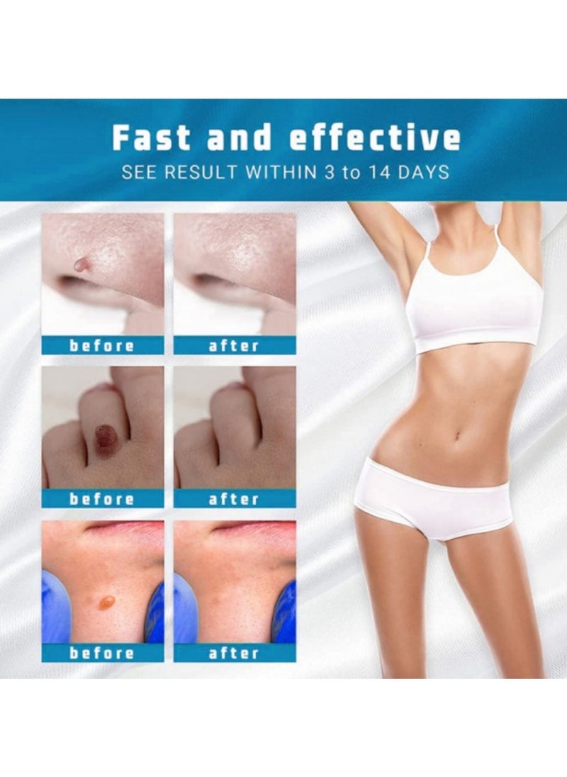 iBealee Wart Removal Essential Oil A Gentle Safe With Natural Extracts For All Skin Types Universal For Both Men And Women  - Image 4