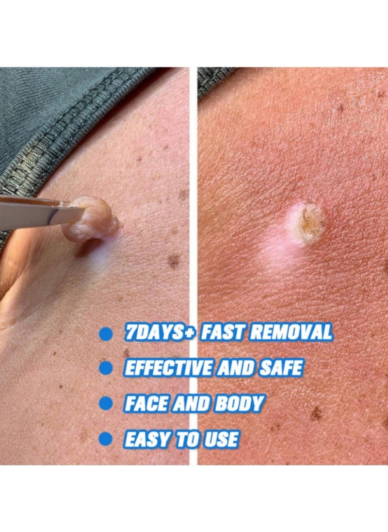 iBealee Wart Removal Essential Oil A Gentle Safe With Natural Extracts For All Skin Types Universal For Both Men And Women  - Image 3