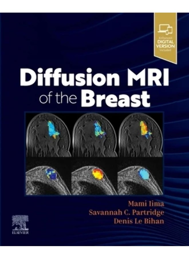 Diffusion MRI of the Breast 