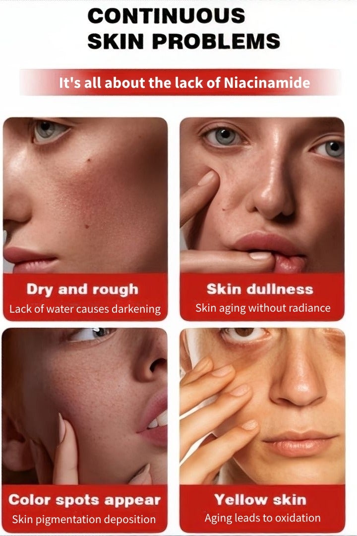 Fearlex Advanced Brightening Serum – 10% Niacinamide & 4% Tranexamic Acid with Hyaluronic Acid and Vitamin B12, Improves Skin Texture & Hydration, Dark Spot Corrector for Even Skin Tone - Image 2