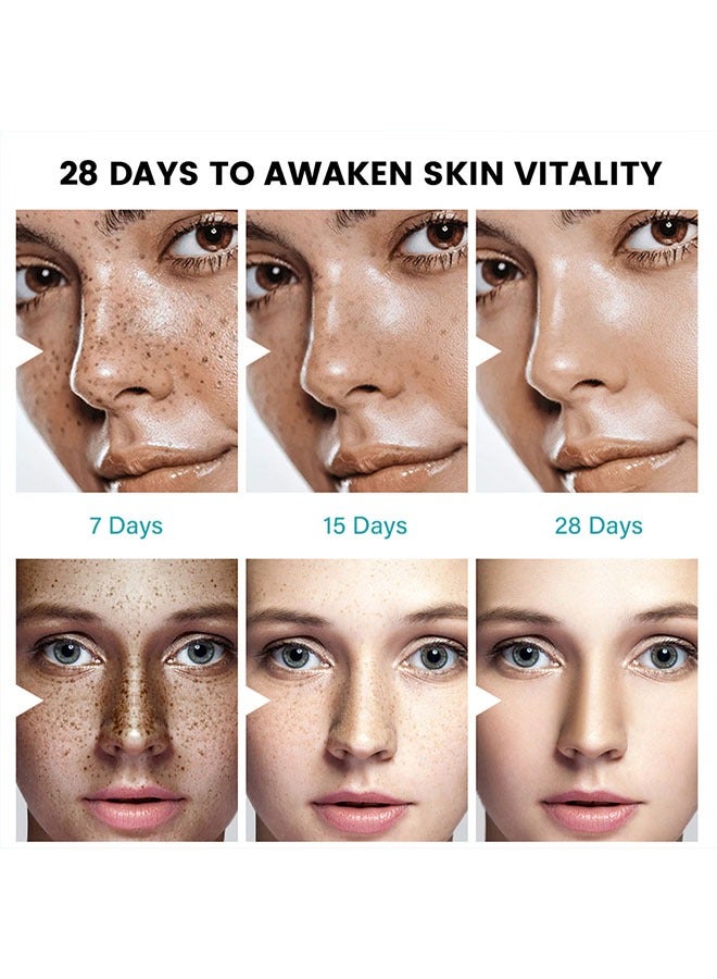 سوميفون كريم تخفيف الكلف - (تخفيف تبييض البقع الداكنة وتفتيح 100٪ مكونات طبيعية) فرط التصبغ ، الكلف ، النمش ، بقع الشمس - لجميع أنواع البشرة 20 جم - Image 5