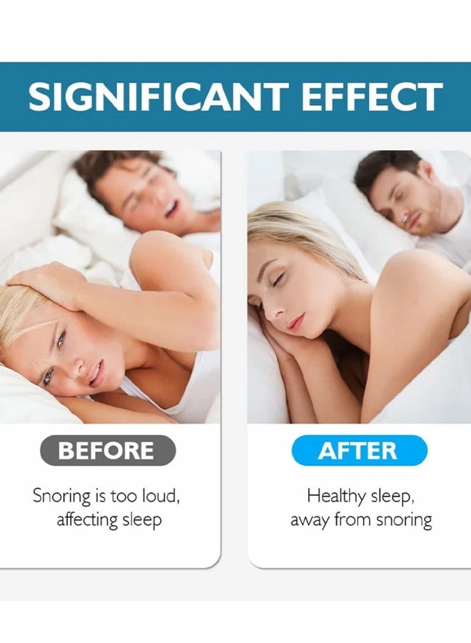 مقاطع الأنف المضادة للشخير جهاز موسع الأنف تحسين عادات التنفس في الفم لتخفيف ضيق التنفس للجنسين 6 قطع - Image 4