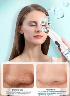 Blackhead Remover Pore Vacuum with Hot & Cold Water Compress,  Pore Vacuum with 3 Suction Power, 6 Probes. Electric Acne Comedone Whitehead Extractor Tools for Face & Nose - pzsku/ZBF039B91DFC5AC0A298FZ/45/_/1734327223/0664de2c-d3c9-4fb8-b649-7cf2c8027354