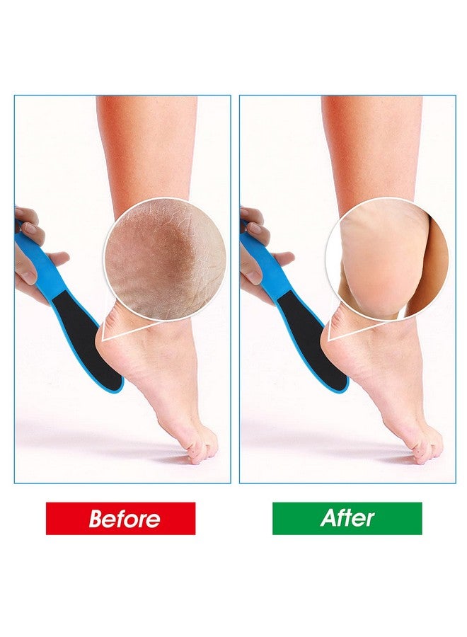 WLLHYF 4 Pieces Double Sided Pedicure Foot File Foot Scraper Exfoliator Remover Dead Skin Hard Skin Calluses Foot Scrubber Reusable Foot Care Pedicure Tool For Wet And Dry Cracked Feet 2 Sizes - Image 3