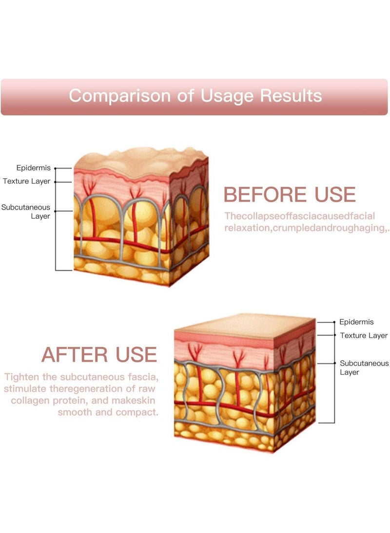 جهاز تجميل البشرة  يساعد على تقليل التجاعيد   5 سرعات و3 أوضاع لتجديد شباب البشرة - Image 4