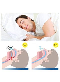 TFIXOL 8PCS/Set Snoring Solution Anti Snoring Devices Snore Stopper Nose Vents Nasal Dilators For Better Sleep Sleeping Aid  - Image 4