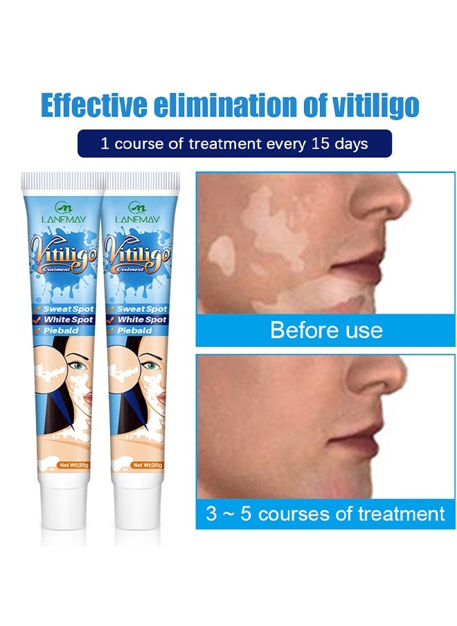 LANEMAY Vitiligo Ointment, Vitiligo Care Cream for Skin Vitiligo, Psoriasis, Leukoplakia, Reduces White Spots, Improve Skin Pigmentation Regulating 20g  - Image 2