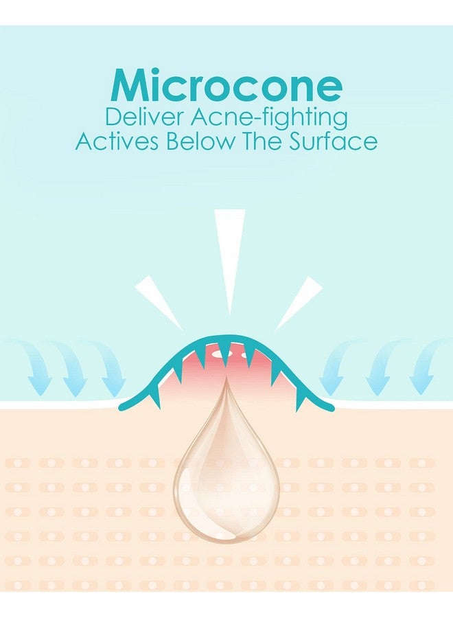 هيرو لابس 1+ رقعة حب الشباب ميكرودارت من +1HEROLABS (18 رقعة) - هيالورونات، حمض الساليسيليك، فيتامين سي، رقعة ميكرودارت لعلاج البثور العميقة والمبكرة والمخفية (18 رقعة (عبوة من قطعة واحدة)) - Image 4