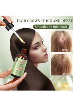 QANZIRE Rosemary Hair Oil Hair Care Essence Promotes Hair Growth, Strengthens Hair, Nourishes The Scalp, Is Light And Non-Greasy, Improves Scalp Circulation, Suitable for Both Men and Women  - Image 2