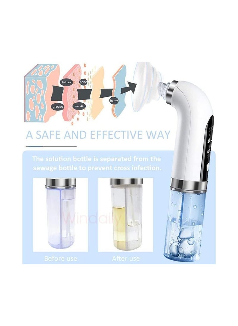 ZHENG JC Blackhead Remover Facial Peeling Device, Facial Pore Cleaner Tool - 2pcs(A) - Image 3