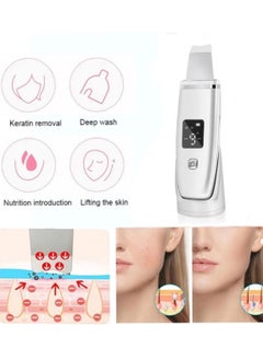 ZHENG JC Blackhead Remover Facial Peeling Device, Facial Pore Cleaner Tool - 2pcs(A) - pzsku/ZBF2B68BA2D4792B95241Z/45/_/1730818976/6b8c32cf-23bb-45b8-97ba-82e8bd220764