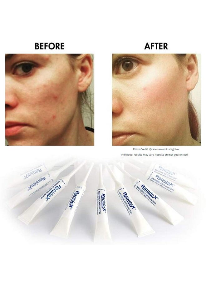 Repechage - Rapidex Marine Exfoliator Natural Facial Exfoliating Scrub With Glycolic & Alpha Hydroxy Acids Deep Pore Cleansing Gentle Face Exfoliator For Antiaging - Image 1