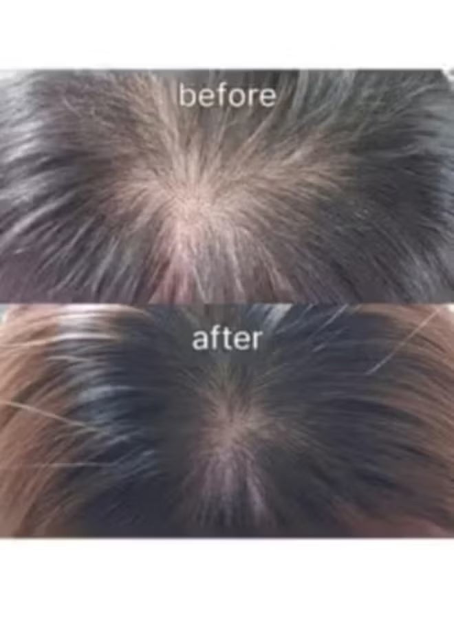 Revive Therapy Hair Scalp & Brow Ampoule 15ml - Image 3