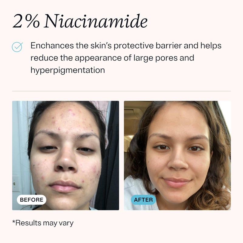 MDacne â€“ Retinol 0.25% and Niacinamide 2% Cream, Reduces Blemishes and Improves Skin Texture without Irritation - Image 4