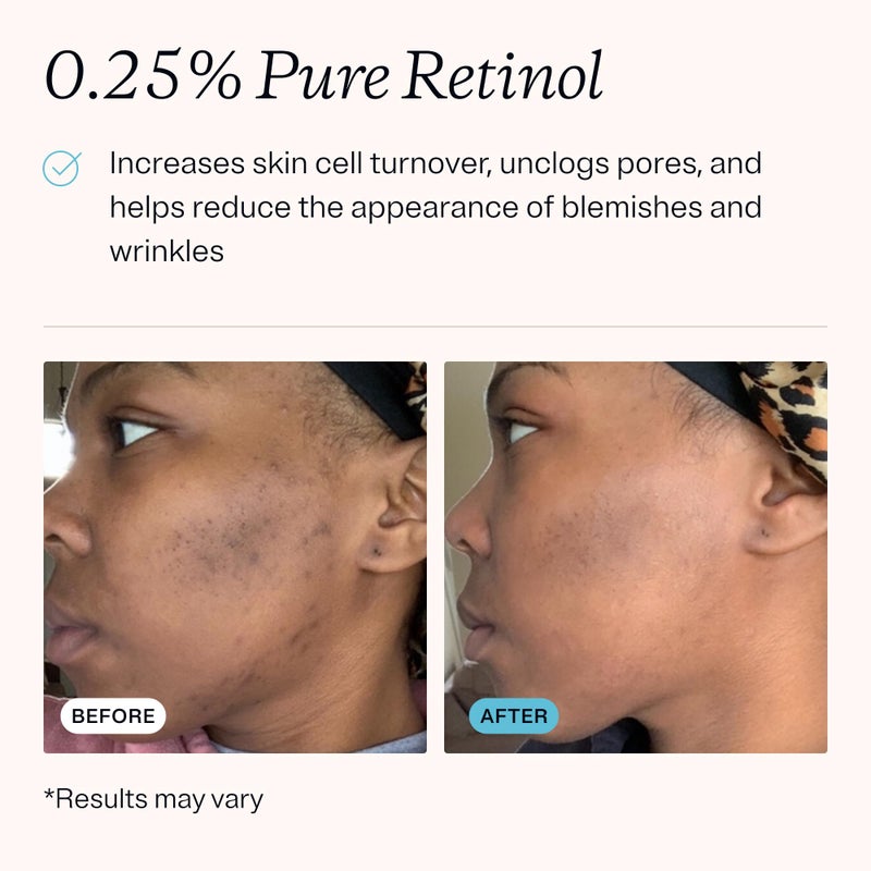 MDacne â€“ Retinol 0.25% and Niacinamide 2% Cream, Reduces Blemishes and Improves Skin Texture without Irritation - Image 3