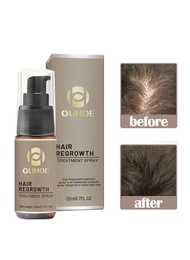 OUHOE - Hair Regrowth Treatment Spray,  7 Day Rapid Growth Hair Serum Essence Oil Regrow, Ginger Essential Oil Stop Hair Loss Hair, Thinning Treatment Hair Growth Oil for Women & Men 20ml - Image 1