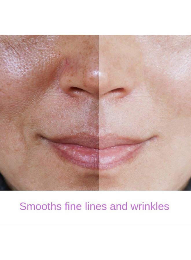 essence of arcadia RETINOL 2.5% Serum, Professional Strength Anti- Aging Formula With Hyaluronic Acid and Vitamin E by Essence of Arcadia, Minimize Wrinkles, Fade Dark Spots - Image 5