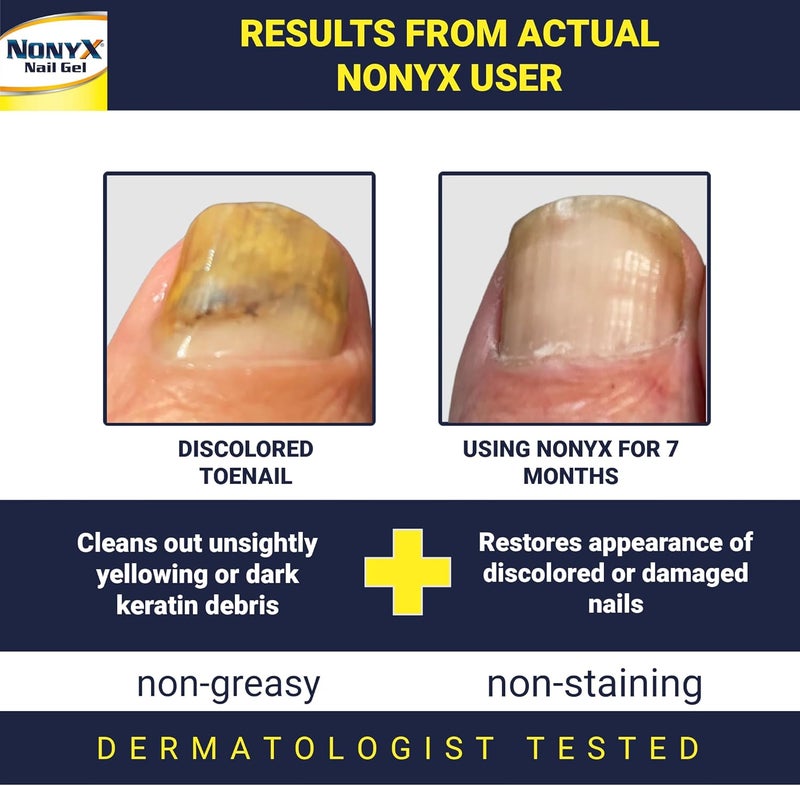 Nonyx Fungal Nail Clarifying Gel - 4oz - Image 2