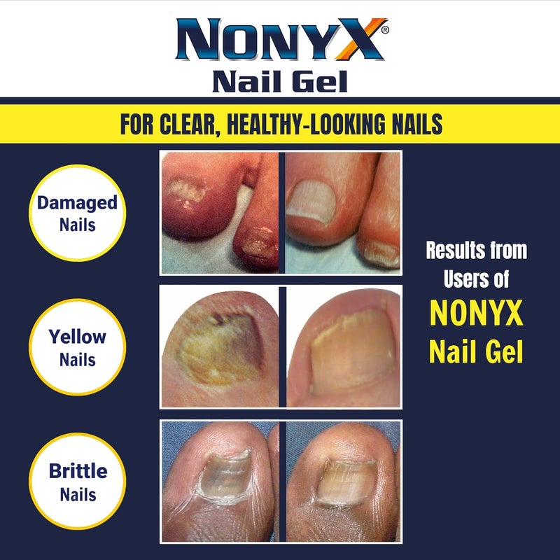 Nonyx Fungal Nail Clarifying Gel - 4oz - Image 5