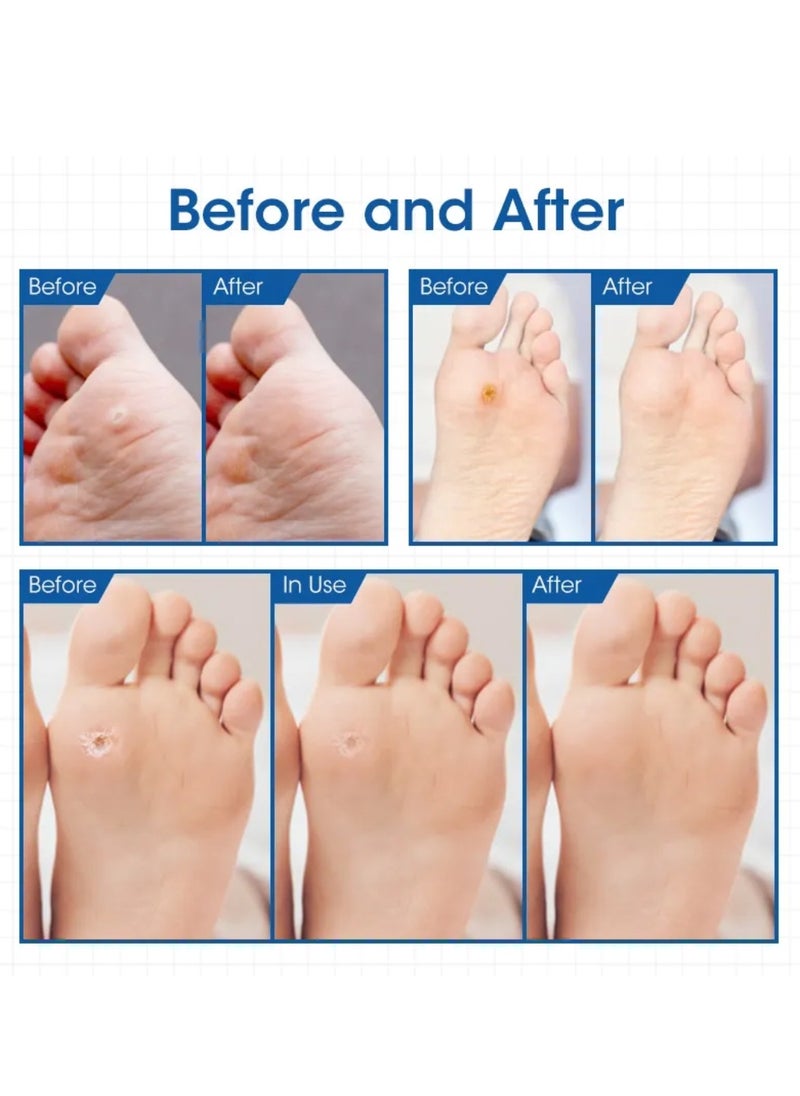 MQ 24 Pcs Corn Remover Pads Foot Corn Remover Patch Wart Remover Corn Removal Ideal for Relief Corn Pain and Foot Care Corn Plasters with Hole for Feet Hand Toe Corn Removal Pads  - Image 3