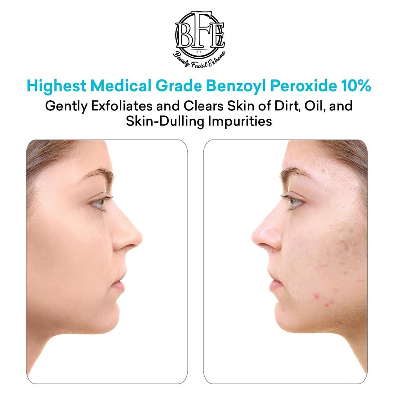 Beauty Facial Extreme Acne Face wash Treatment with Benzoyl Peroxide 10% - Fight Acne Blemishes on Contact for Cystic Breakouts, Oily Skin, Clogged Pores, Blackhead, Whitehead & Pimples. Achieve Clear Skin. - Image 3