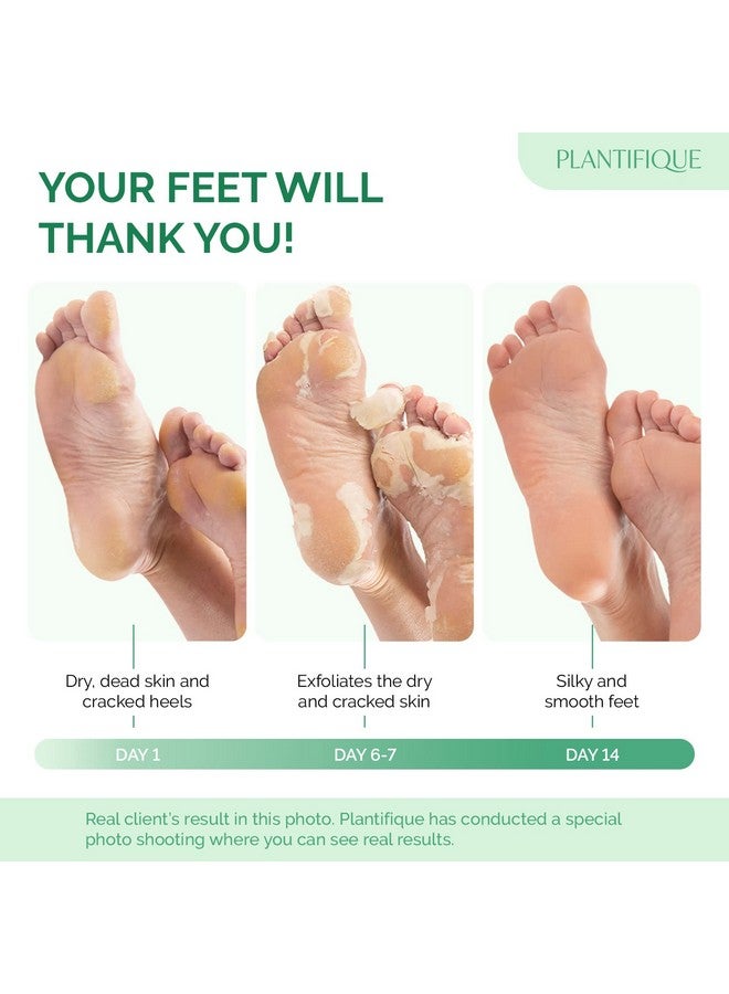 Plantifique Foot Peel Mask With Peach 2 Pack Peeling Foot Mask Dermatologically Tested Repairs Heels & Removes Dry Dead Skin For Baby Soft Feet Exfoliating Foot Peel Mask For Dry Cracked Feet - Image 2