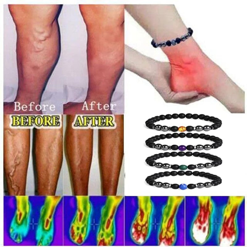 comfrt Anti-Swelling Black Obsidian Slimming Anklets for Women Men, Adjustable Lymphatic Drainage Magnetic Therapy Bracelet Anklet Yoga Beads Anxiety Relief Magnet Anklet (2PCS G) - Image 2