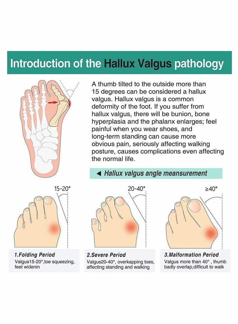 Captaintech 3 Pairs Toe Corrector Toe Separators for Overlapping Toes Silicone Bunion Corrector, Toe Separators with 2 Loops, Big Toe Space Suitable for Bunion and Overlap Toe 6 PCS - Image 5