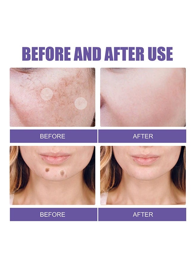 EELHOE Dark Spot Removal Patch ,Spot Treatment for Face, Fast-Acting Dark Spot Corrector patch for Face and body Hyperpigmentation, Fades Melasma, Freckle, Sun Spots, Evens Skin Tone, Age Spot patch 144 patchs  - Image 4