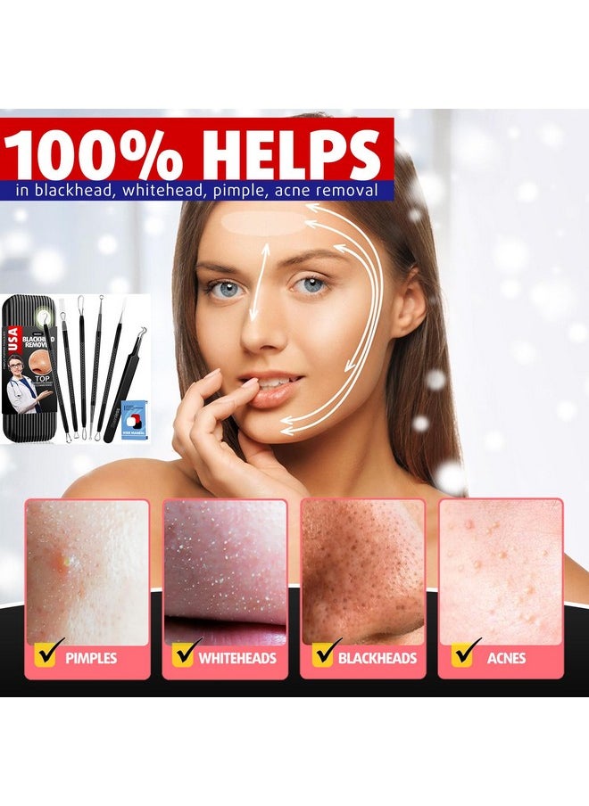 Pimple Popper Tool Kit Blackhead Remover Tools Blackhead Extractor Tool Pimple Extractor Tool Zit Popper Tool For Acne Whitehead Comedone Pimple Zit On Nose With Travel Case