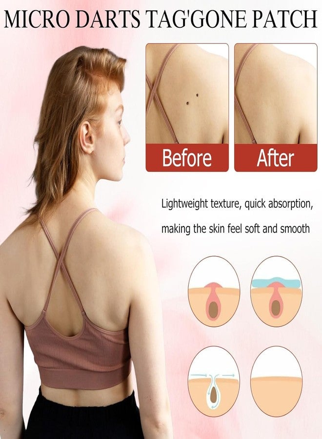 Elvana Pro Micro Darts Tag Gone Skin Patches, Natural Nano Pimple Plasters, Microdart Plasters, Acne Pimple Patches, Micro Pimple Plaster's for All Skin Types (4 Sheet) - Image 4