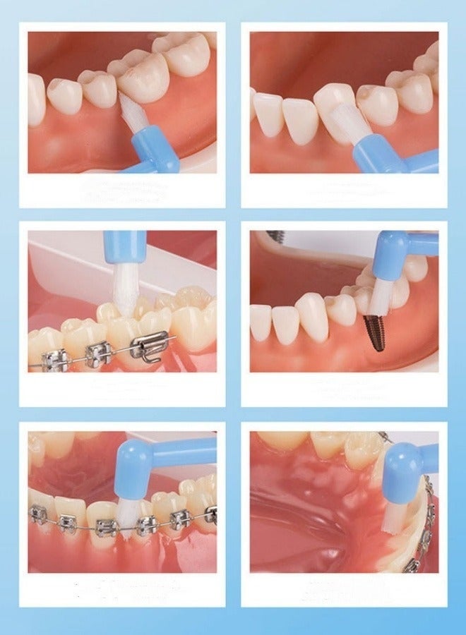 8 قطع فرشاة أسنان لتقويم الأسنان لتقويم الأسنان، رأس صغير ناعم ورأس مسطح وفرشاة أسنان لتقويم الأسنان وتنظيف تفاصيل الأسنان - Image 5