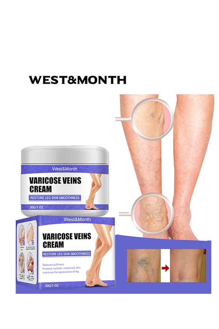 West&Month Varicose Veins Cream Relief Phlebitis Angiitis，Vein Healing Varicose Veins Foot Muscle Treatment Cream 30g - Image 1