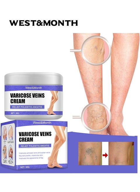Varicose Veins Cream Relief Phlebitis Angiitis，Vein Healing Varicose Veins Foot Muscle Treatment Cream 30g