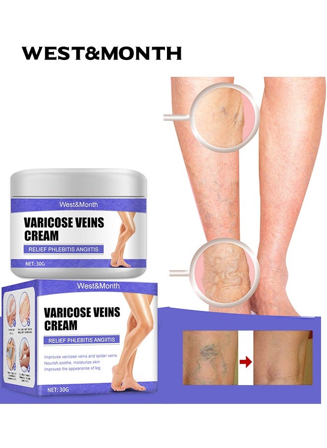West&Month Varicose Veins Cream Relief Phlebitis Angiitis，Vein Healing Varicose Veins Foot Muscle Treatment Cream 30g  - Image 1