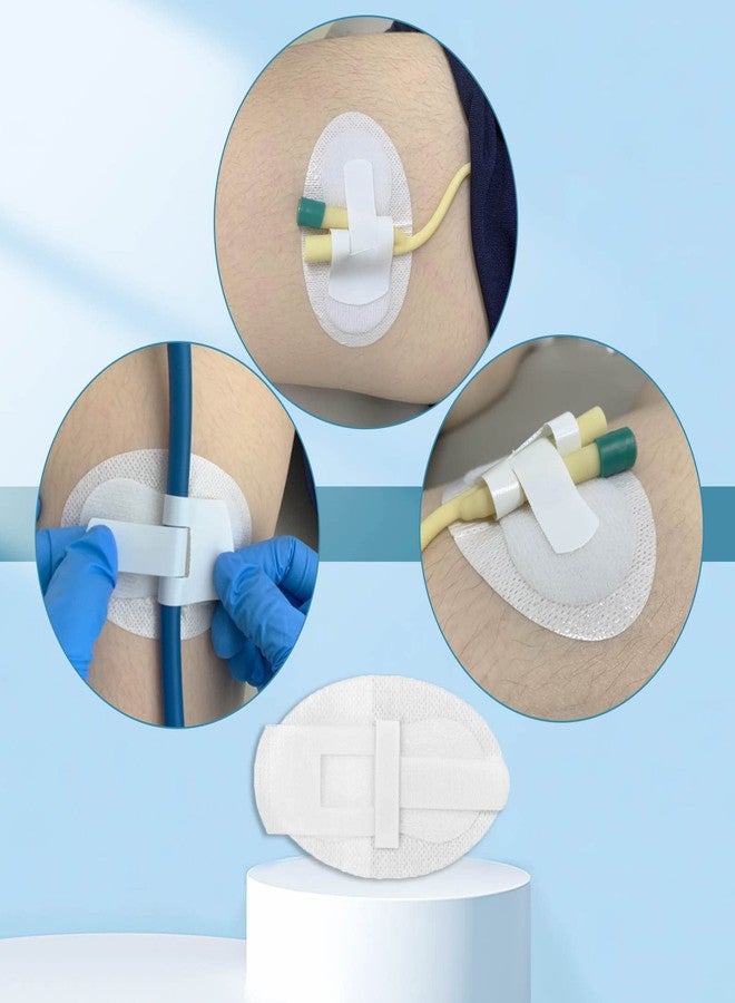 MESINURS Urinary Tube Stabilization Fixation Stickers, Adhesive Pads for Leg Bag Support, Anti-Slip Drainage Tube Holder for Daily Care (White, 5) - Image 3