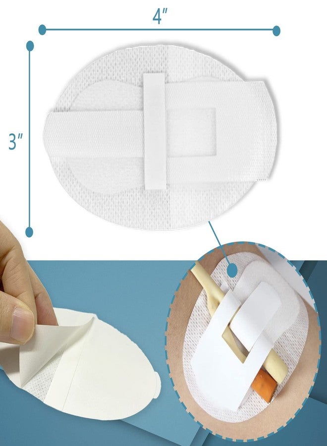 MESINURS Urinary Tube Stabilization Fixation Stickers, Adhesive Pads for Leg Bag Support, Anti-Slip Drainage Tube Holder for Daily Care (White, 5) - Image 2