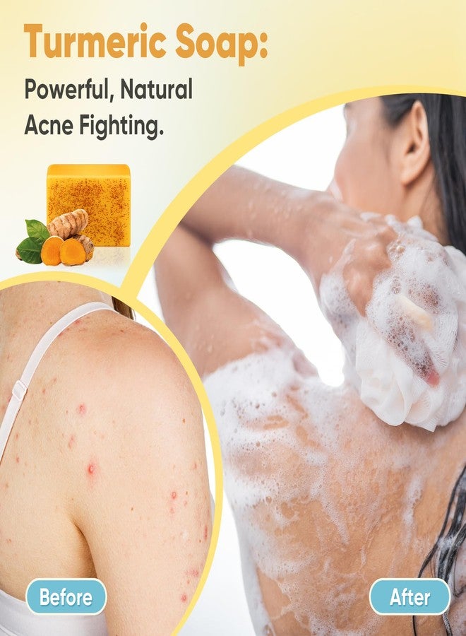 Treeroot 4 Pack Turmeric Soap, 100g Kojic Acid and Turmeric Soap Bar, Gently Clean the Face, Contains Retinol, Collagen, Vitamin C, Shea Butter, Used for Face & Body, SLS Free - Image 5