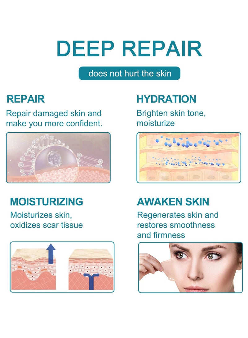 Elaimei لفة صفائح إزالة الندبات المصنوعة من السيليكون بطول 3 أمتار، تنعيم وتسطيح الندبات الناتجة عن الجراحة والإصابات والحروق وحب الشباب والقسم القيصري لفة صفائح ندبات السيليكون الناعمة - Image 4