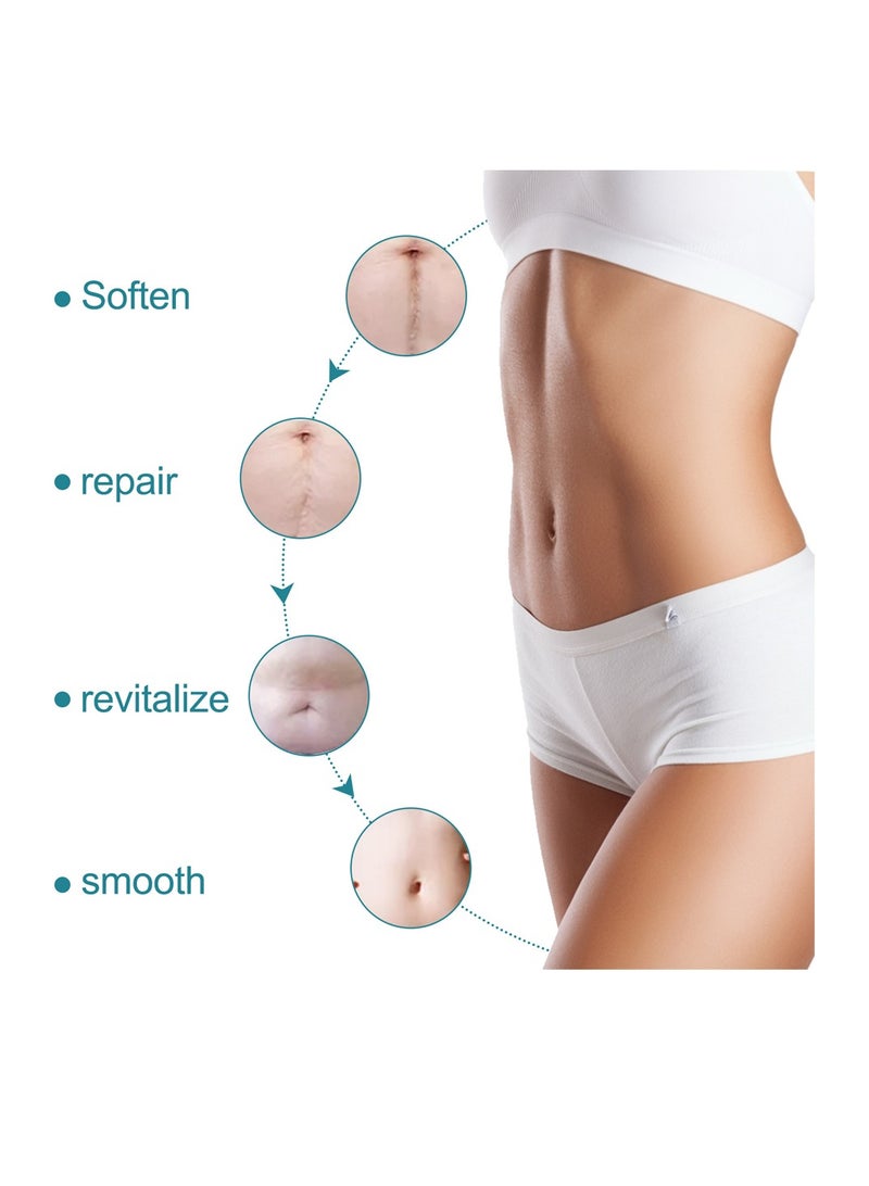 Elaimei لفة صفائح إزالة الندبات المصنوعة من السيليكون بطول 3 أمتار، تنعيم وتسطيح الندبات الناتجة عن الجراحة والإصابات والحروق وحب الشباب والقسم القيصري لفة صفائح ندبات السيليكون الناعمة - Image 5