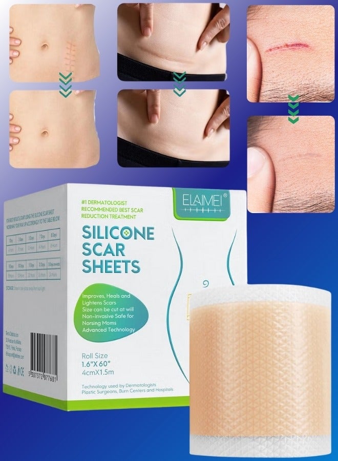 Elaimei لفة صفائح إزالة الندبات المصنوعة من السيليكون بطول 3 أمتار، تنعيم وتسطيح الندبات الناتجة عن الجراحة والإصابات والحروق وحب الشباب والقسم القيصري لفة صفائح ندبات السيليكون الناعمة - Image 1