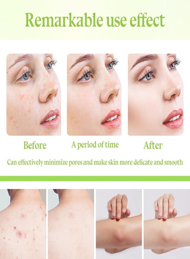 Fusang 3PCS Gentle Exfoliating Gel,Moisturizing Facial Exfoliator,Deep Cleansing Peeling Gel for Face and Body,Non-greasy Exfoliating Face Scrub,Lightweight Facial Scrub Exfoliator for All Skin Types - Image 4